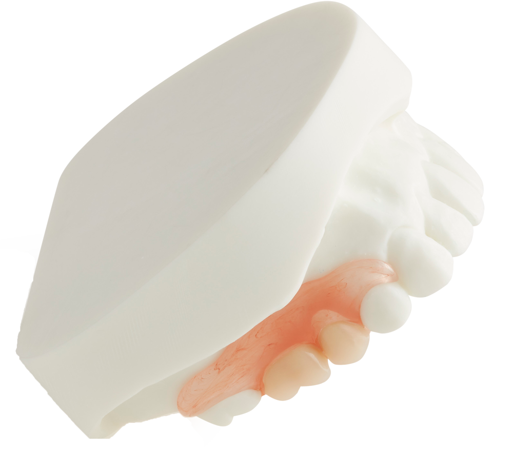 Removable Prosthodontics Partial Dentures Upper Partial Dentures